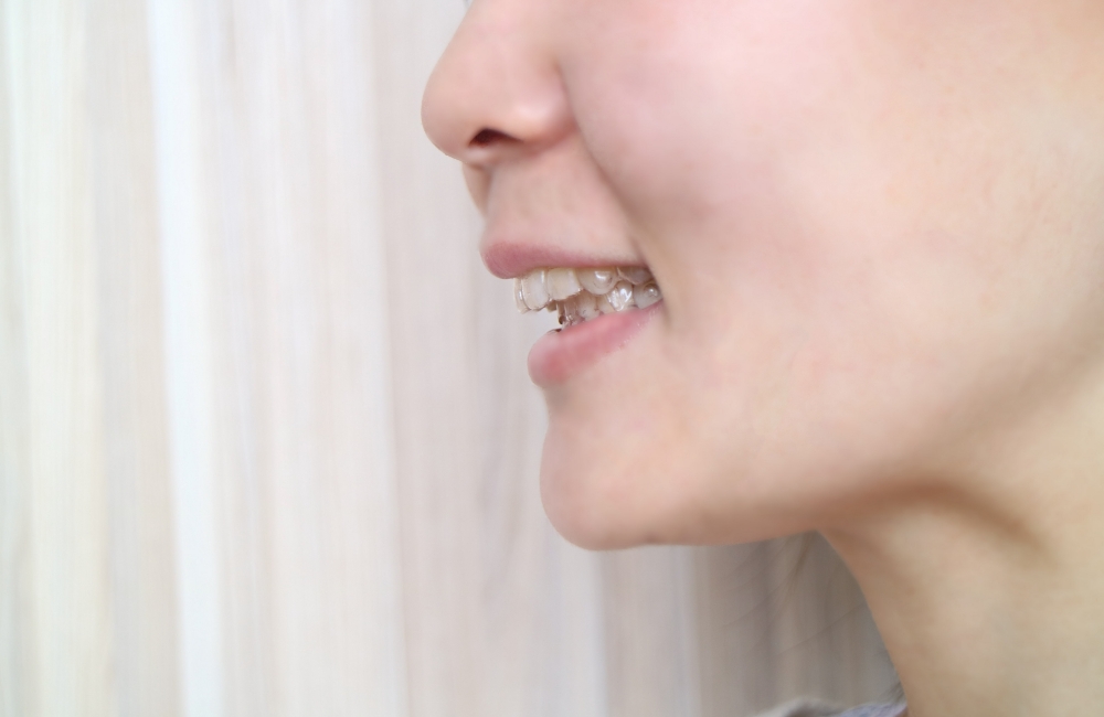 咬み合わせとは？