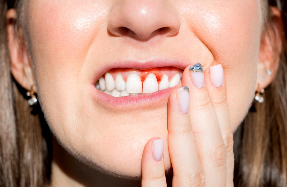 成人の8割が歯周病または歯周病予備軍です